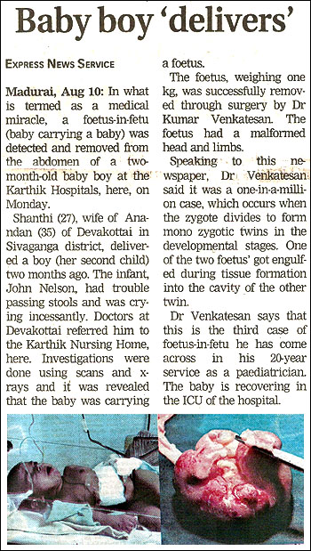 FOETUS IN FETU (Baby Carrying a Baby)